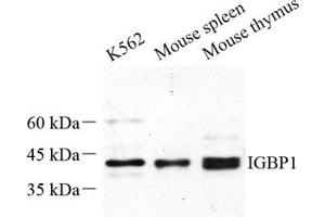 Western blot analysis of IGBP1 (ABIN7074276) at dilution of 1: 500 (IGBP1 anticorps)