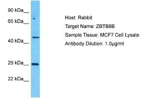 Host: Rabbit Target Name: ZBTB8B Sample Tissue: Human MCF7 Whole Cell Antibody Dilution: 1ug/ml