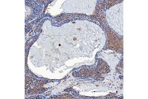 IHC analysis of SETD3 using anti-SETD3 antibody (ABIN7600293). (SETD3 anticorps  (AA 173-468))