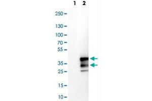 Western Blot analysis of Lane 1: negative control (vector only transfected HEK293T cell lysate) and Lane 2: over-expression lysate (co-expressed with a C-terminal myc-DDK tag in mammalian HEK293T cells) with VPS24 polyclonal antibody . (CHMP3 anticorps)