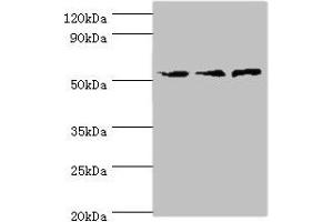 Western blot All lanes: ACVR1C antibody at 4 μg/mL Lane 1: Mouse brain tissue Lane 2: HepG2 whole cell lysate Lane 3: Hela whole cell lysate Secondary Goat polyclonal to rabbit IgG at 1/10000 dilution Predicted band size: 55, 38, 47, 50 kDa Observed band size: 55 kDa (ACVR1C/ALK7 anticorps  (AA 22-113))