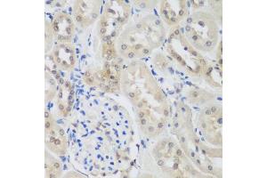 Immunohistochemistry of paraffin-embedded rat kidney using UBE3A antibody (ABIN5975332) at dilution of 1/200 (40x lens). (ube3a anticorps)