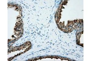 Immunohistochemical staining of paraffin-embedded liver tissue using anti-NME4 mouse monoclonal antibody. (NME4 anticorps)