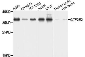 Western blot analysis of extracts of various cells, using GTF2E2 antibody. (GTF2E2 anticorps)
