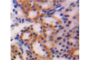 IHC-P analysis of Kidney tissue, with DAB staining. (CTGF anticorps  (AA 25-348))