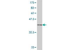 Western Blot detection against Immunogen (36. (GRSF1 anticorps  (AA 87-184))