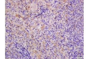 Formalin-fixed and paraffin embedded Rat lung spleen labeled with Anti-THEMIS Polyclonal Antibody, Unconjugated  at 1:300, followed by conjugation to the secondary antibody and DAB staining.
