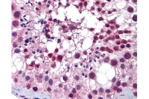 Immunohistochemistry (IHC) image for anti-Polo-Like Kinase 1 (PLK1) (C-Term) antibody (ABIN2782496)