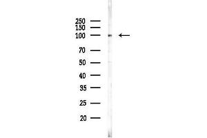 anti-Homeodomain Interacting Protein Kinase 2 (HIPK2) (N-Term) antibody