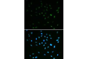 Immunofluorescence analysis of A549 cells using MSH6 antibody (ABIN5971626). (MSH6 anticorps)