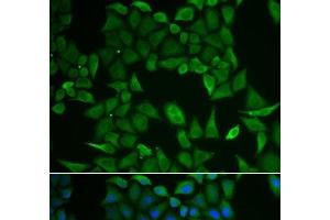 Immunofluorescence analysis of HeLa cells using CLPS Polyclonal Antibody (CLPS anticorps)