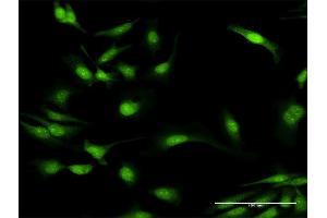Immunofluorescence of purified MaxPab antibody to MYD88 on HeLa cell.