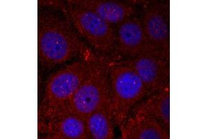 Immunofluorescence staining of methanol-fixed Hela cells using Phospho-SNCA-Y136 antibody. (SNCA anticorps  (pTyr136))