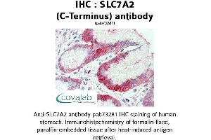 Image no. 2 for anti-Solute Carrier Family 7 (Cationic Amino Acid Transporter, Y+ System), Member 2 (SLC7A2) (C-Term) antibody (ABIN1739417)