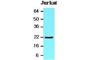 The lysates of Jurkat (20 ug) were resolved by SDS-PAGE, transferred to nitrocellulose membrane and probed with anti-human BID (1:1000). (BID anticorps  (AA 1-195))