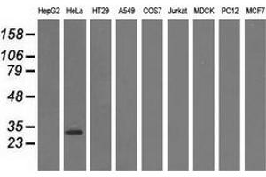 Western blot analysis of extracts (35 µg) from 9 different cell lines by using anti-GSTT2 monoclonal antibody. (GSTT2 anticorps)