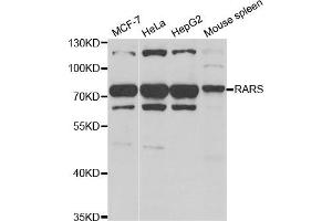 Western Blotting (WB) image for anti-Arginyl-tRNA Synthetase (RARS) antibody (ABIN1980323) (RARS anticorps)