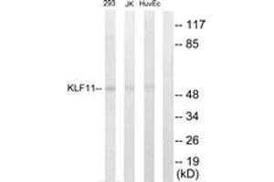 Western blot analysis of extracts from 293/Jurkat/HuvEc cells, using KLF11 Antibody. (KLF11 anticorps  (AA 1-50))