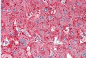 Human Liver (formalin-fixed, paraffin-embedded) stained with APOE antibody ABIN337117 at 2. (APOE anticorps  (AA 305-317))