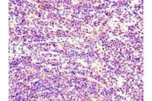 Immunohistochemistry of paraffin-embedded human lymph node tissue using ABIN7170833 at dilution of 1:100 (STIM1 anticorps  (AA 2-350))