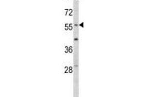 Western blot analysis of EGR1 antibody and mouse NIH3T3 lysate.