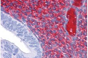 Human Uterus: Formalin-Fixed, Paraffin-Embedded (FFPE)