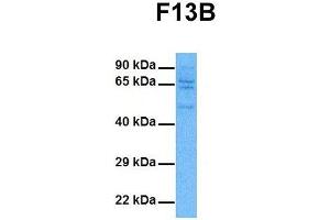 Host:  Rabbit  Target Name:  F13B  Sample Tissue:  Human DLD1  Antibody Dilution:  1. (F13B anticorps  (Middle Region))