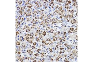 Immunohistochemistry of paraffin-embedded rat ovary using Erlin-2 Rabbit mAb (ABIN7267006) at dilution of 1:100 (40x lens).