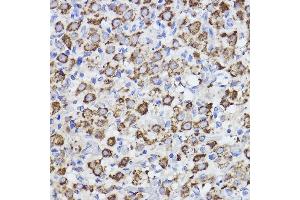 Immunohistochemistry of paraffin-embedded rat ovary using Erlin-2 Rabbit mAb (ABIN7267006) at dilution of 1:100 (40x lens). (ERLIN2 anticorps)