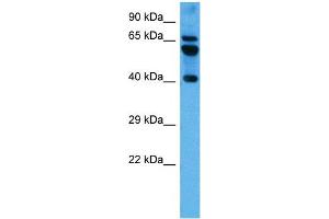 Host:  Mouse  Target Name:  PARD6B  Sample Tissue:  Mouse Brain  Antibody Dilution:  1ug/ml