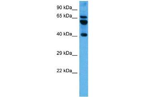 Host:  Mouse  Target Name:  PARD6B  Sample Tissue:  Mouse Brain  Antibody Dilution:  1ug/ml (PARD6B anticorps  (N-Term))