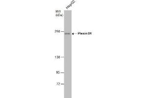 WB Image Plexin D1 antibody [C3], C-term detects Plexin D1 protein by western blot analysis. (PLXND1 anticorps  (C-Term))