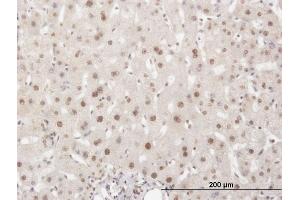 Immunoperoxidase of monoclonal antibody to ELAVL1 on formalin-fixed paraffin-embedded human liver.