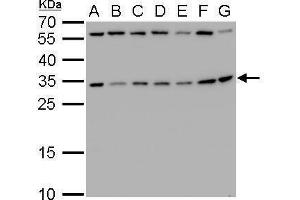 WB Image RPS3A antibody detects RPS3A protein by Western blot analysis. (RPS3A anticorps)