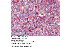 Immunohistochemistry with Human Spleen lysate tissue at an antibody concentration of 5. (BCL11A anticorps  (N-Term))