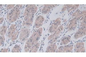 Detection of JAM2 in Human Stomach Tissue using Polyclonal Antibody to Junctional Adhesion Molecule 2 (JAM2)