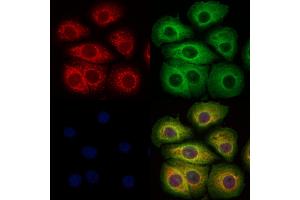 ABIN6265508 and ABIN6273329 staining Hela cells by IF/ICC. (TCTN2 anticorps  (Internal Region))