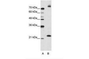 Image no. 2 for anti-Frizzled Family Receptor 9 (FZD9) (AA 181-230) antibody (ABIN202792)
