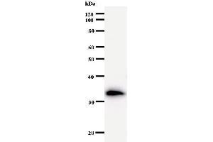 Western Blotting (WB) image for anti-Transportin 3 (TNPO3) antibody (ABIN933162)