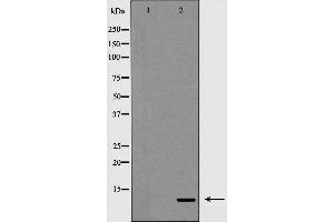 Western blot analysis on 293 cell lysate using Insulin Antibody,The lane on the left is treated with the antigen-specific peptide. (Insulin anticorps)