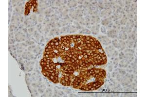 Immunoperoxidase of monoclonal antibody to RAB3B on formalin-fixed paraffin-embedded human pancreas.