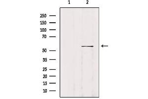 Western blot analysis of extracts from B16F10, using WASF2 Antibody.