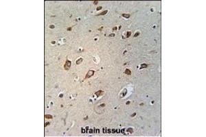 anti-WD Repeat Containing Planar Cell Polarity Effector (WDPCP) (AA 676-705), (C-Term) antibody