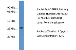 WB Suggested Anti-CABP4  Antibody Titration: 0. (CABP4 anticorps  (N-Term))