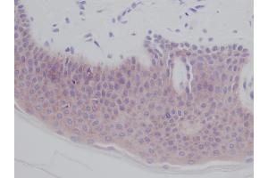 Immunohistochemistry (IHC) image for anti-Interleukin 1 alpha (IL1A) antibody (ABIN2474888)