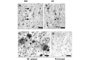 Detection of CYP46A1 in human cortex using CYP46A1 polyclonal antibody .