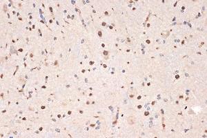 Immunohistochemistry of paraffin-embedded mouse spinal cord using DDX17 Rabbit mAb (ABIN7266688) at dilution of 1:100 (40x lens).