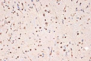 Immunohistochemistry of paraffin-embedded mouse spinal cord using DDX17 Rabbit mAb (ABIN7266688) at dilution of 1:100 (40x lens). (DDX17 anticorps)