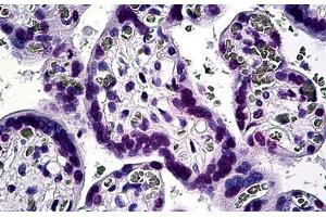 Human Placenta: Formalin-Fixed, Paraffin-Embedded (FFPE)
