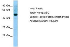 Image no. 1 for anti-Abl-Interactor 2 (ABI2) (N-Term) antibody (ABIN6749949) (ABI2 anticorps  (N-Term))